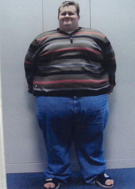"Omul Gogoașă" a ajuns de la 300 de kilograme, la 80! În doar 17 luni! Cum a reușit