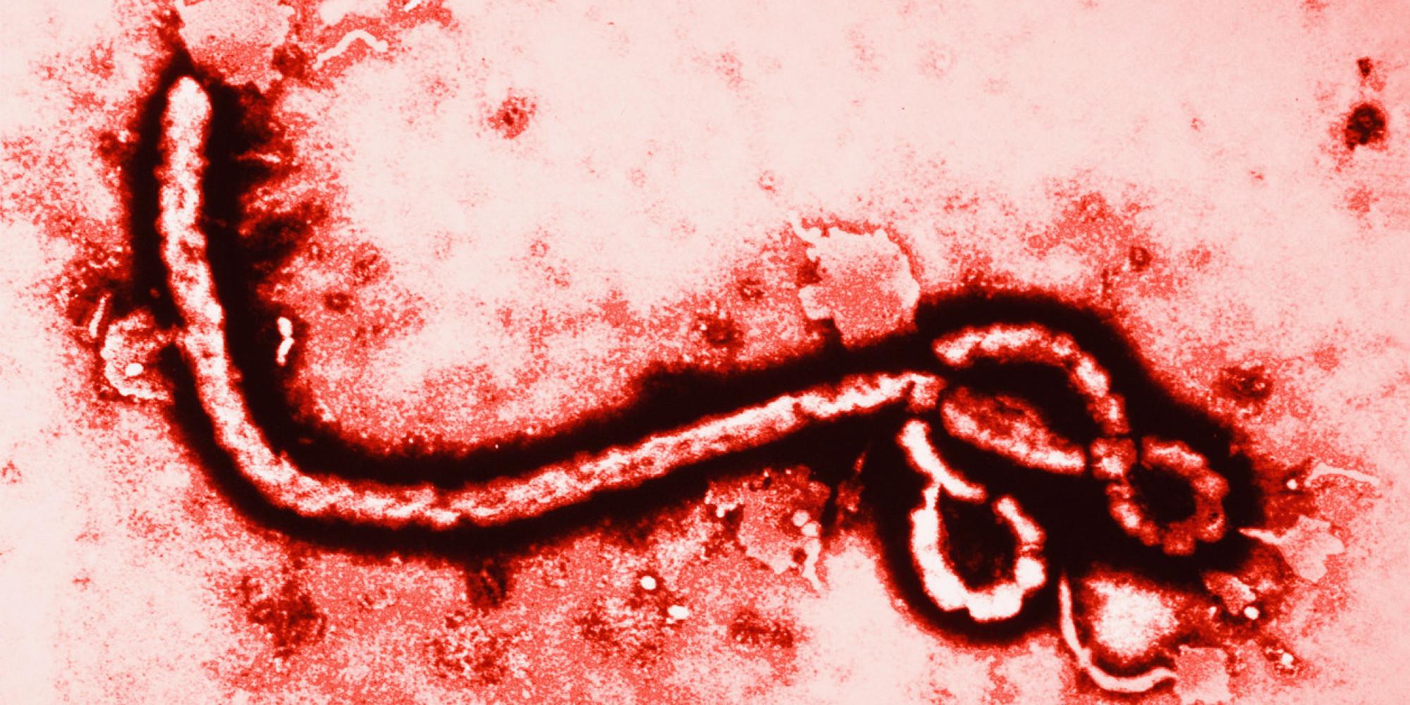 Virusul Ebola, de neoprit! A fost &icirc;nregistrat PRIMUL caz din SUA, &icirc;nsă pacientul a fost internat după NOUĂ ZILE!