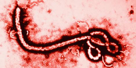 Virusul Ebola, de neoprit! A fost înregistrat PRIMUL caz din SUA, însă pacientul a fost internat după NOUĂ ZILE!