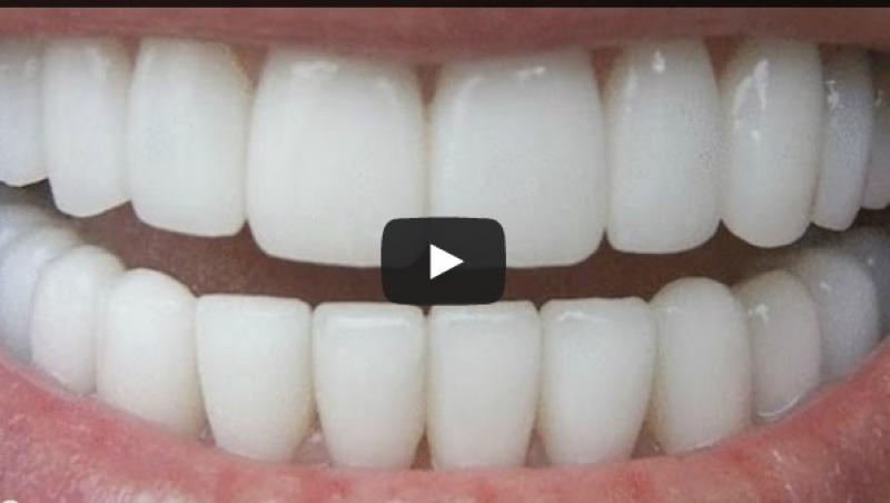 Video demonstrativ! Uite cum poți să-ți albești dintii, imediat, cu ingrediente naturale