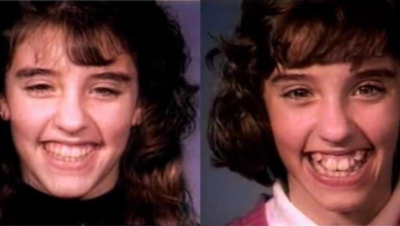 VIDEO: Cum să îţi îndrepţi dinţii în 60 de secunde! Rezultatele sunt spectaculoase