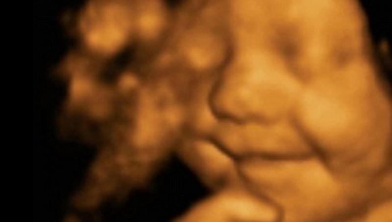 Părinții și medicii au fost de-a dreptul ȘOCAȚI! Ce făcea bebelușul în burta mamei la 31 de săptămâni