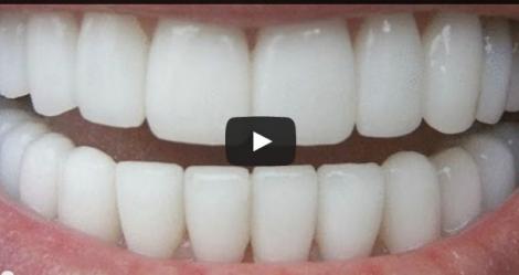 VIDEO! Albeşte-ţi dinţii în mod natural în doar trei minute!
