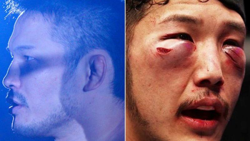 Galerie FOTO: Cum arată luptătorii din UFC după o luptă! ATENȚIE, IMAGINI DURE!!!