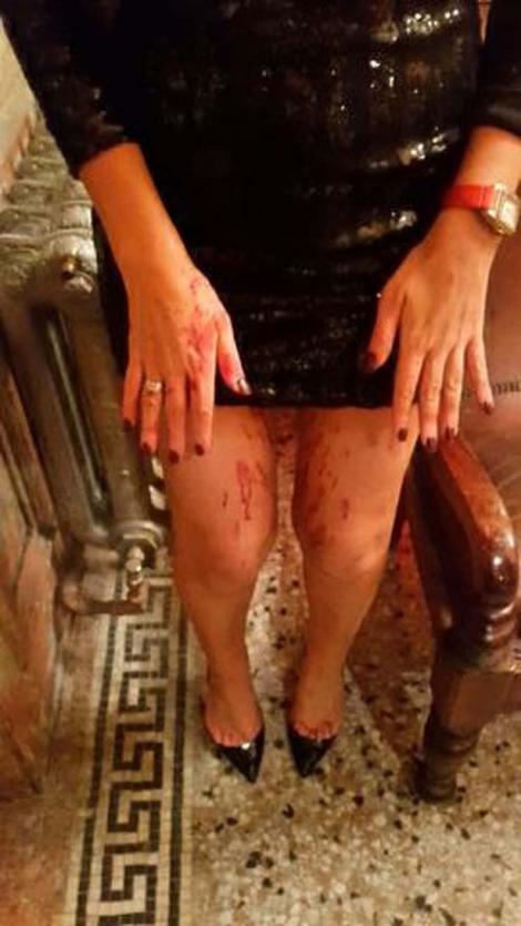 Imagini DURE: O actriţă iubită de mii de oameni a fost bătută crunt, în mijlocul străzii! Plină de sânge, desfigurată, şi-a îngrozit fanii