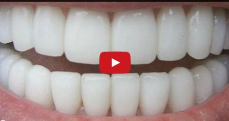 VIDEO! Cel mai simplu truc pentru albirea dinților! Vei avea o dantură de invidiat în doar 3 minute!