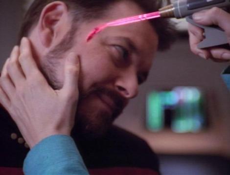 Leziuniile pielii ar putea fi tratate cu un dispozitiv din "Star Trek"!