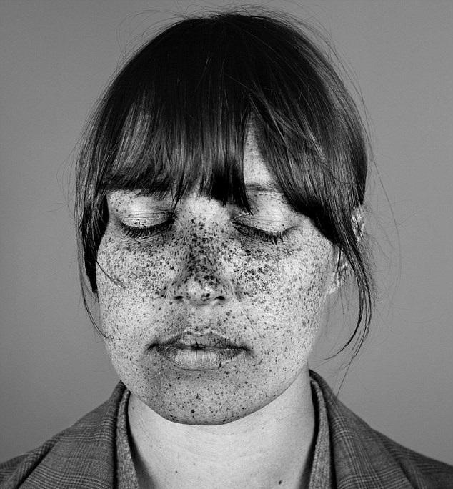 După ce vei privi aceste imagini, nu vei dori să te mai bronzezi niciodată!