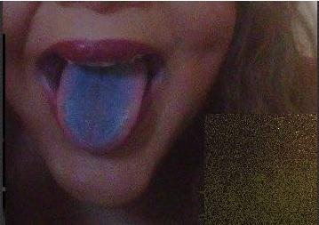 FOTO: Cum arată femeia care şi-a injectat ciment şi lipici &icirc;n faţă, pentru a fi ca "fetele din reviste"