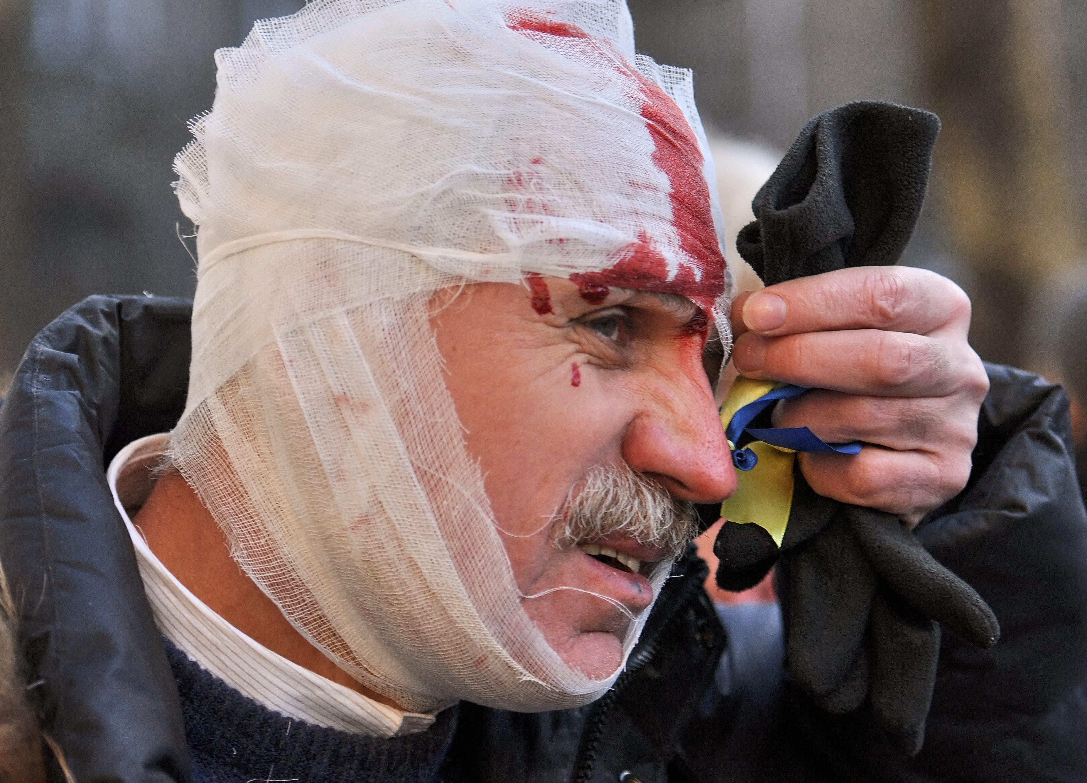 Victimele de la Kiev, omagiate &icirc;n faţa ambasadei Ucrainei din Bucureşti