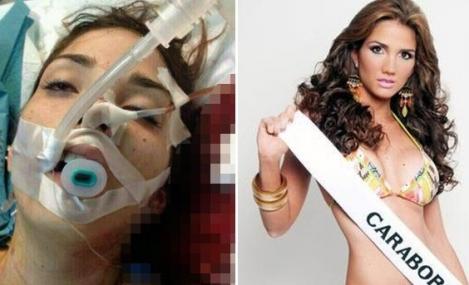 Imaginea morții, în Venezuela: Proteste cu opt morţi şi 137 de răniţi, Miss Turism 2013 a fost ucisă!