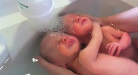 VIDEO EMOȚIONANT! Gestul unor gemeni chiar după naștere