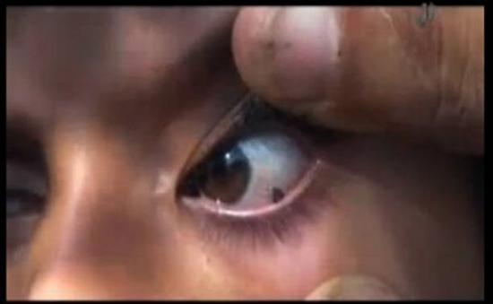 O fetiţă de 12 ani pl&acirc;nge cu pietre &icirc;n loc de lacrimi