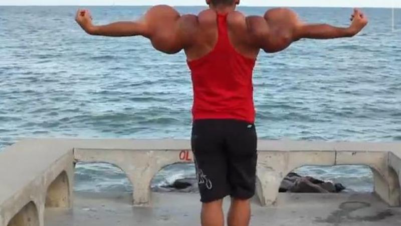 Popeye din Brazilia riscă să moară din cauza muşchilor săi! (VIDEO)