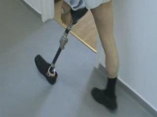 ȘOCANT: Destin amputat de un sistem bolnav