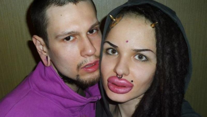 FOTO: Cum arată femeia care şi-a făcut peste 100 de operaţii pentru mărirea buzelor