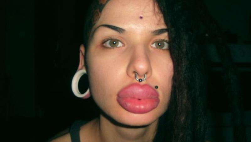 FOTO: Cum arată femeia care şi-a făcut peste 100 de operaţii pentru mărirea buzelor