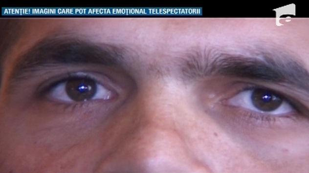 Caz ȘOCANT! Bărbatul fără jumătate de cap are nevoie de operație!