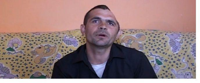 Trăieşte cu jumătate de craniu şi e condamnat la suferinţă!