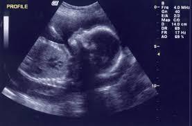 ȘOCANT: O femeie și-a adus copilul &icirc;n caserolă la IML!