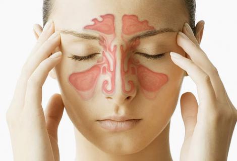 Cum să tratezi infecţiile sinusurilor