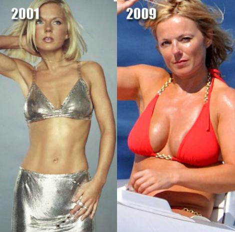 Operațiile estetice fac minuni! Vedetele de la Hollywood, înainte și după!