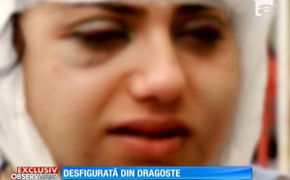 Pumni, &icirc;n loc de flori! O t&acirc;nără din Bucureşti, desfigurată din dragoste