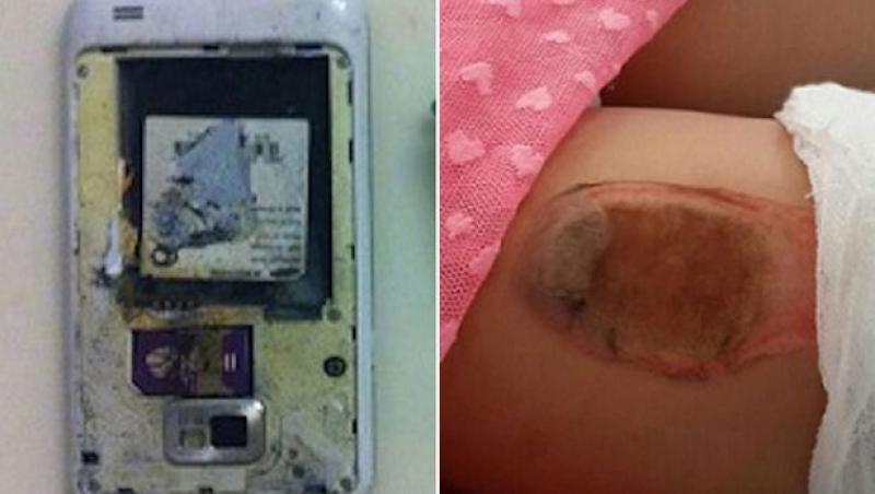 Telefonul mobil a băgat-o în spital! O fetiţă a fost internată cu arsuri grave