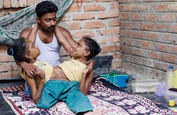 VIDEO ŞOCANT! Totul se &icirc;mparte la... două! Siamezele care au același IUBIT!