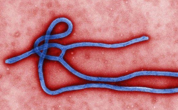 99 la sută, rom&acirc;nul transferat la Institutul &rdquo;Matei Balș&rdquo; NU ARE EBOLA!