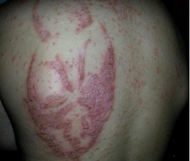 Imagini ŞOCANTE! Ce a păţit un BĂIEŢEL din cauza unui TATUAJ cu HENNA te va lăsa fără cuvinte! E plin de&hellip;