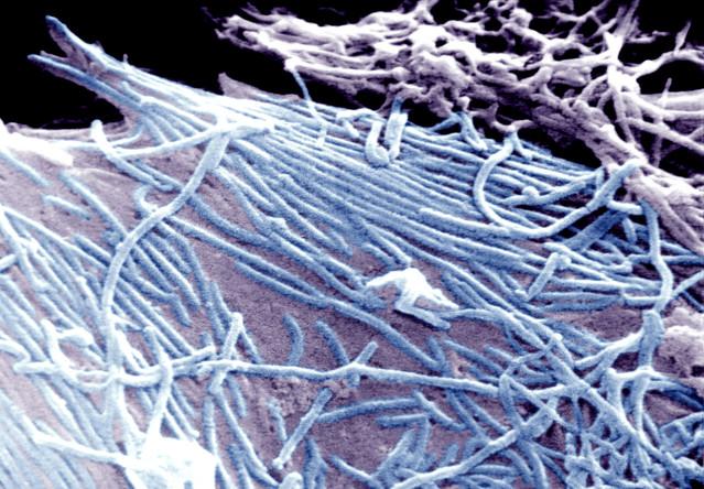 Alertă de Ebola &icirc;n Germania!