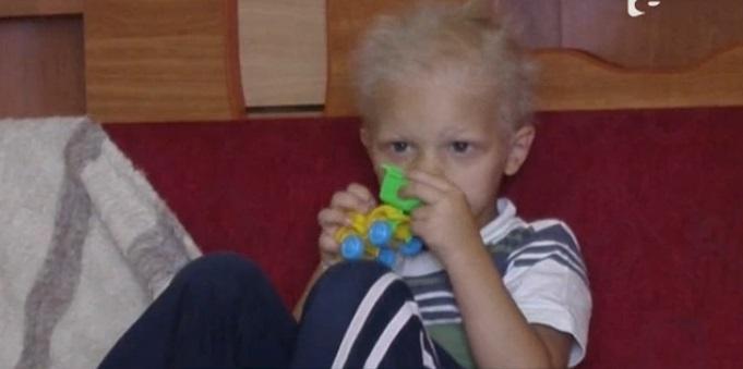 Povestea uluitoare a băiețelului care NU TRANSPIRĂ NICIODATĂ