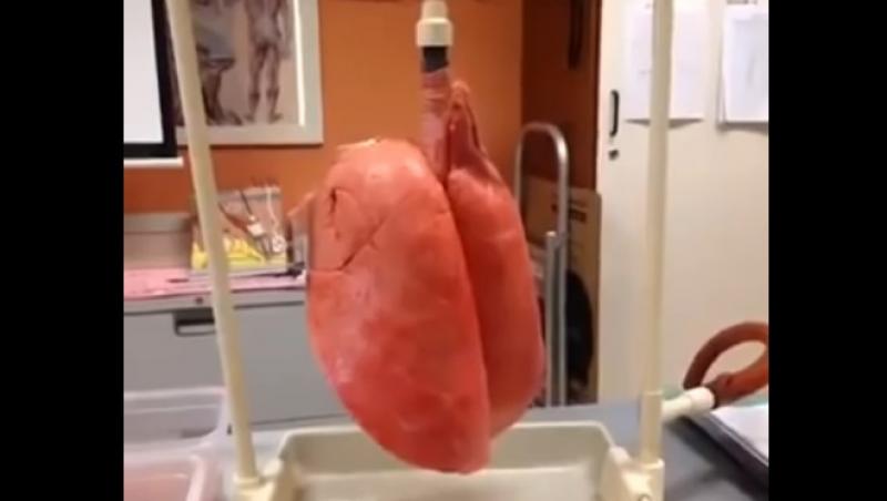 VIDEO ȘOCANT! Uite în ce hal arată plămânii tăi dacă ești fumător!