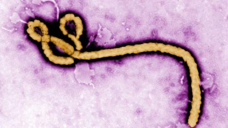 Unul dintre americanii infectaţi cu Ebola A AJUNS în SUA