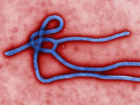 Ebola: seamănă cu o răceală dar ucide fără milă. Iată simptomele şi cum să te fereşti