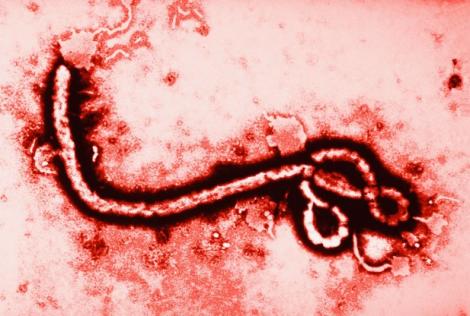 Ebola se extinde în SUA!? Un bărbat cu simptome similare acestui virus este tratat la New York!