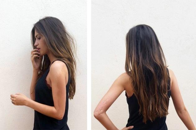 FOTO: Un accident din copilărie o b&acirc;ntuie și-n prezent! Imagini ȘOCANTE cu Sara Carbonero, jumătatea lui Iker Casillas