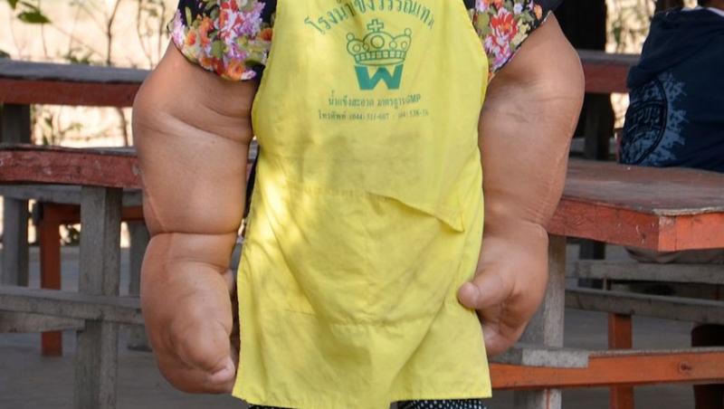 Duangjay Samaksamam, femeia cu cele mai mari mâini din lume