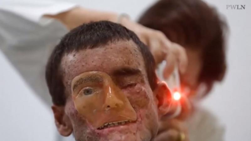 O boală TERIBILĂ afectează locuitorii unui sat! Li se TOPEȘTE PIELEA pur și simplu