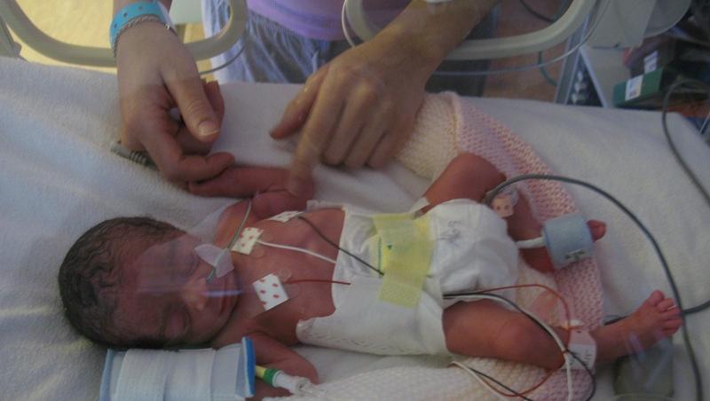 Oprește-te din tot ce faci ACUM! Trebuie să vezi asta! Cum și-a salvat o mamă copilul născut prematur, te va emoționa INSTANT!