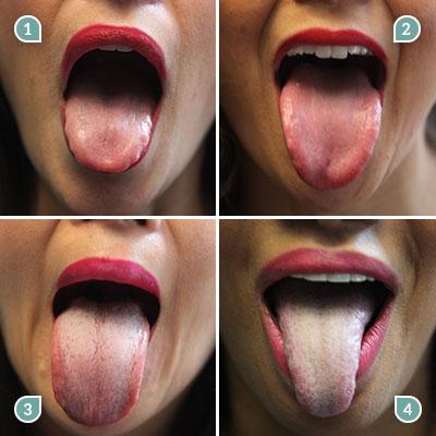 Care este culoarea limbii tale și ce spune ea despre sănătatea ta