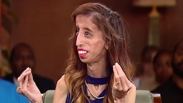 Cea mai ur&acirc;tă femeie din lume a devenit un model pentru milioane de oameni! Ea &icirc;ți dă cea mai tare lecție de viață!