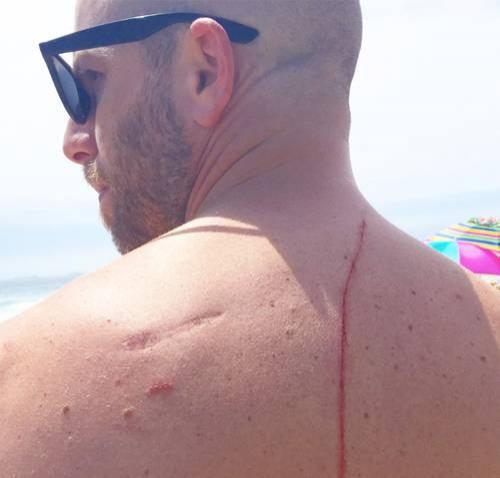 L-a atacat un rechin, dar asta i-a salvat viața! Un bărbat a trecut printr-o situație desprinsă parcă dintr-un scenariu de film!