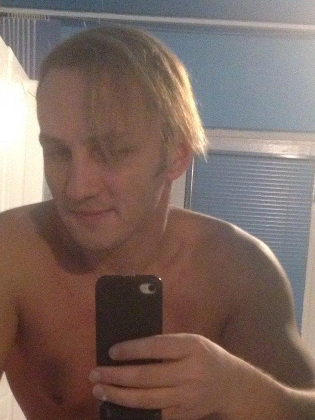 ȘOC și groază! Mihai Trăistariu duce o luptă grea, după ce a pierdut toate firele implantate: "Mi-a căzut tot părul!". Cum arată acum!