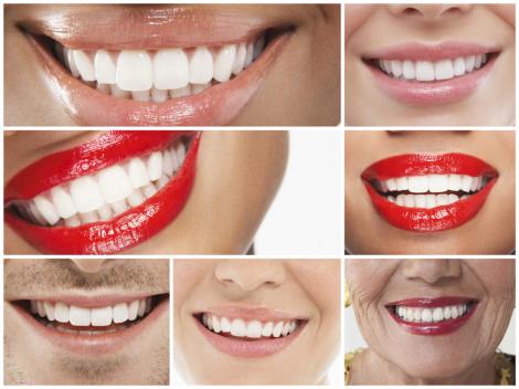 Priveşte bine în oglindă! Forma dinţilor spune multe despre personalitatea ta! Din ce categorie faci parte?