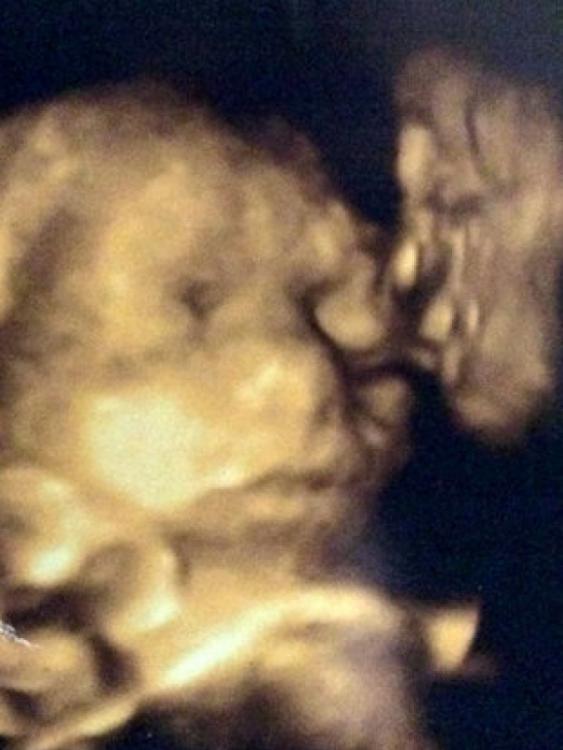 O femeie &icirc;nsărcinată a avut ȘOCUL vieții ei la ecografie! Cine &icirc;i săruta bebelușul din p&acirc;ntece