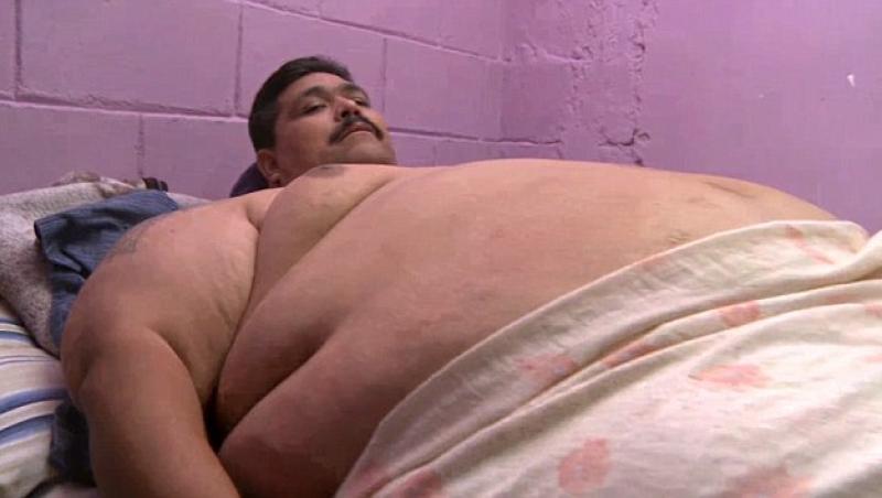 Andres Moreno speră ca operaţia la stomac să îl ajute să aibă o viaţă normală