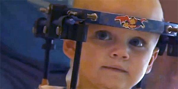 A fost decapitat &icirc;ntr-un accident, dar medicii i-au pus capul la loc! Miracol &icirc;n lumea medicinei!