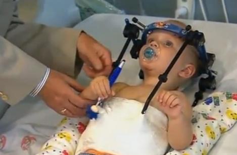 FOTO: I-a fost smuls capul din gât, dar medicii au reuşit să-l salveze! Un copil de 16 luni îşi revine miraculos după ce a fost decapitat
